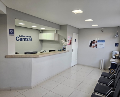 2 recepção